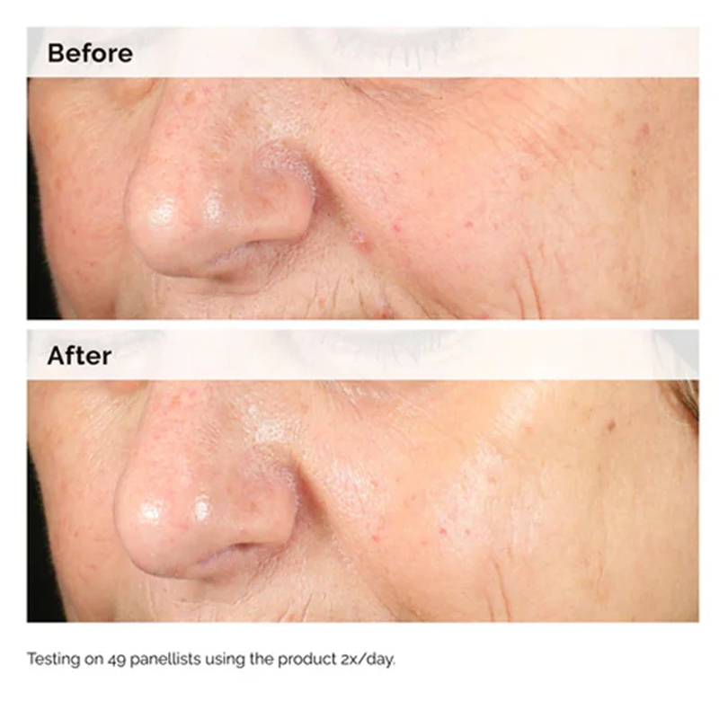 Alpha Arbutin 2% + HA 30ml Sér - Alpha Arbutin Serum avis et prix