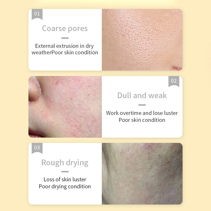 30 pièces SADOER vitamine C ma - Skincare Omg avis et prix